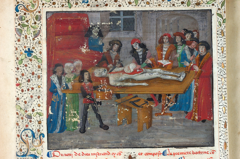 Gui de Chauliac, La Grande chirurgie, XIVe s.